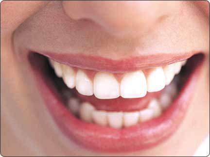 Teeth Whitening Treatment, Teeth Whitening Treatment India, Cost Whitening