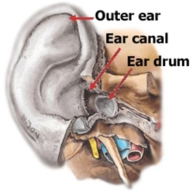 Inner Ear Disorders, Ear Disorders Vertigo, Ear Disorders Surgery Mumbai India, Hearing-Impairment