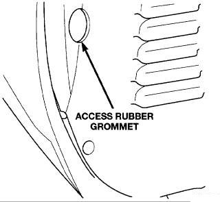 Grommet Removal Tool, Grommet Removal Diagnostics Procedures India, Grommet Removal Surgery Delhi India