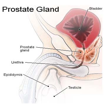 Cost Cancer, Prostate Cancer Types, Prostate Cancer Causes Surgery, Prostate Cancer Symptoms