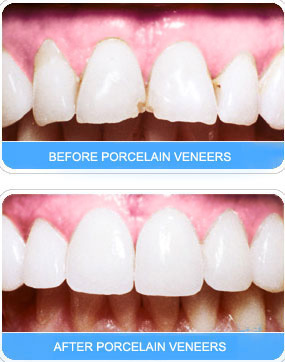  Exodontia, Cost Effective Dental Empress Treatment, Orthodontic Treatments, Dental Care Center