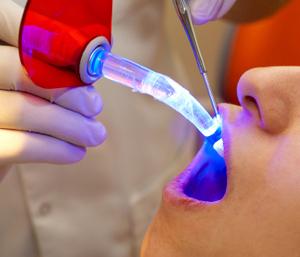 Laser Dentistry Treatment, Laser Dentistry Treatment India, Cost Laser Dentistry, Laser Surgery