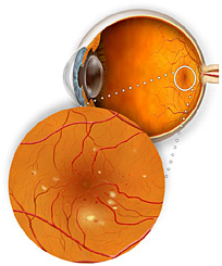 Diabetic Retinopathy Surgery, Eye Specialists, Eyestrain, Eye Tests, Nearsighted, Myopia, Near Vision
