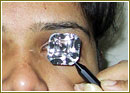 Glaucoma Eye Pressure, Glaucoma Treatment Medications