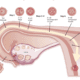 Endometrial Receptivity Array Test