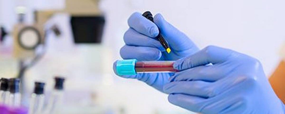 plasma therapy image