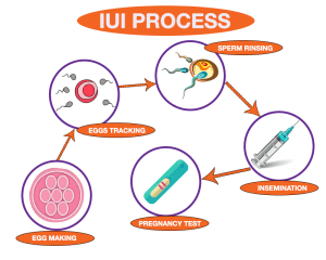 IUI Cost In Gurgaon