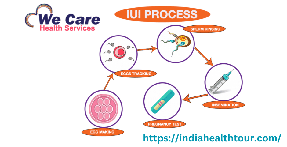 IUI Treatment Cost in India