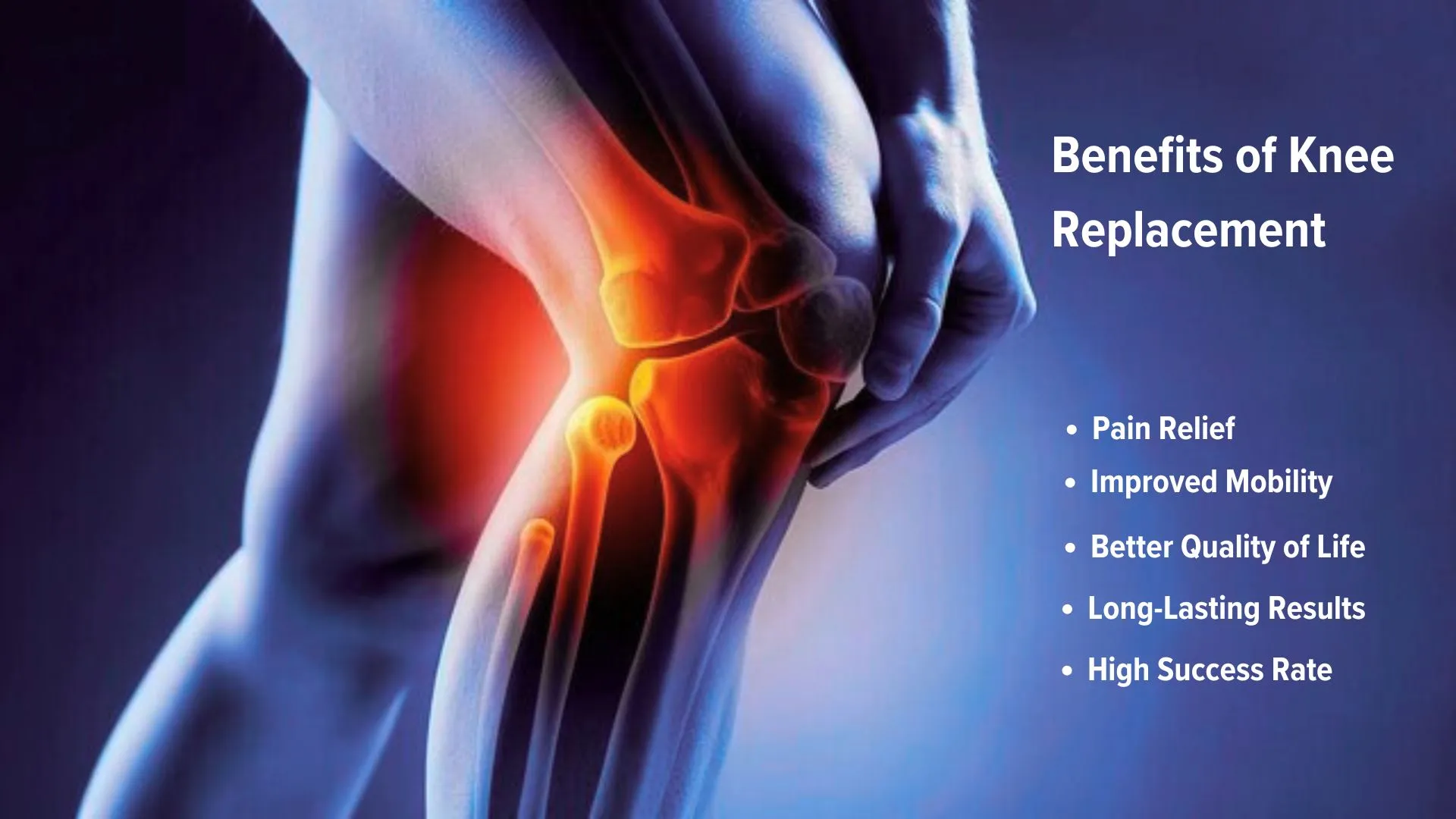 Benefits of Knee Replacement
