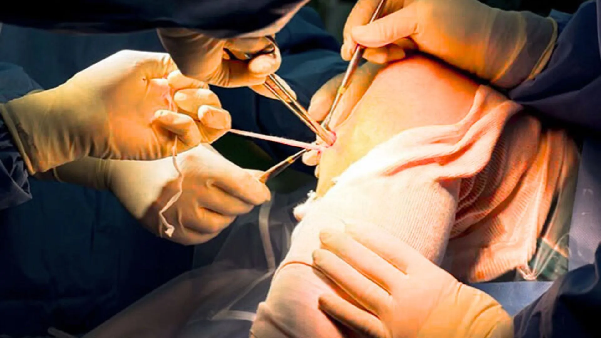Arthroscopy Surgery in India