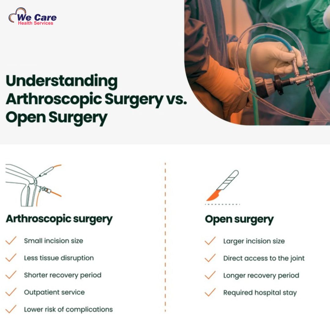 Arthroscopy Vs. Traditional Surgery