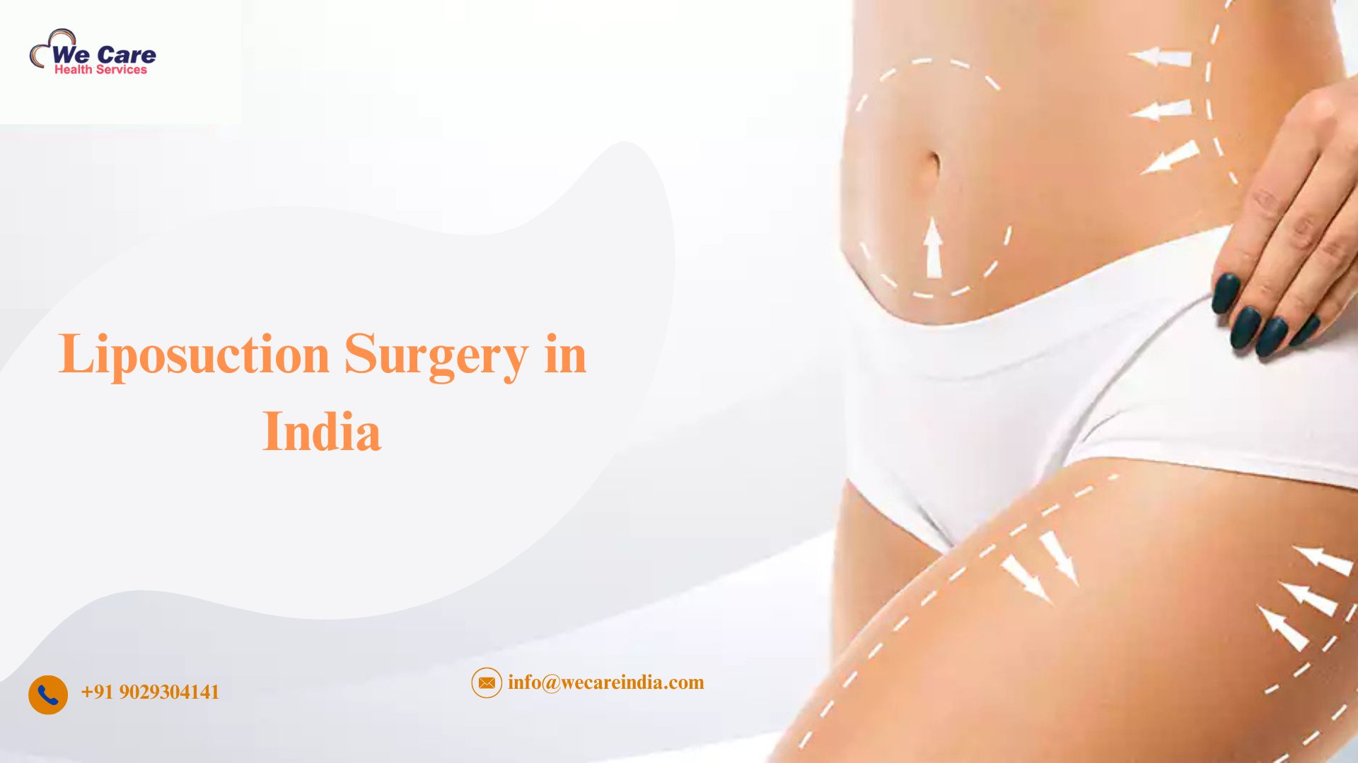 Liposuction Surgery in India