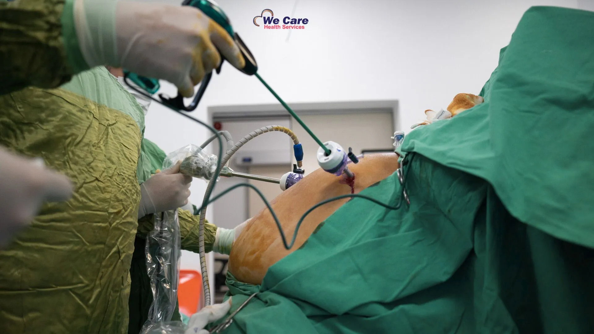 Sleeve Gastrectomy Surgery in India