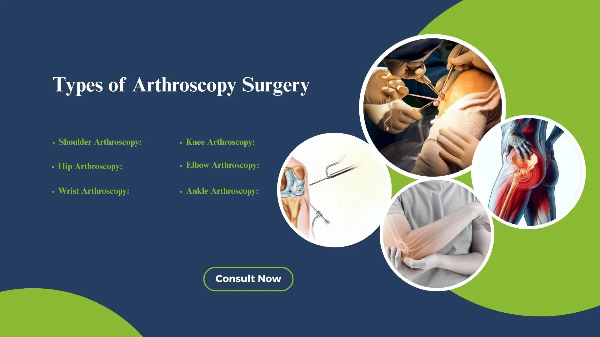 Types of Arthroscopy Surgery
