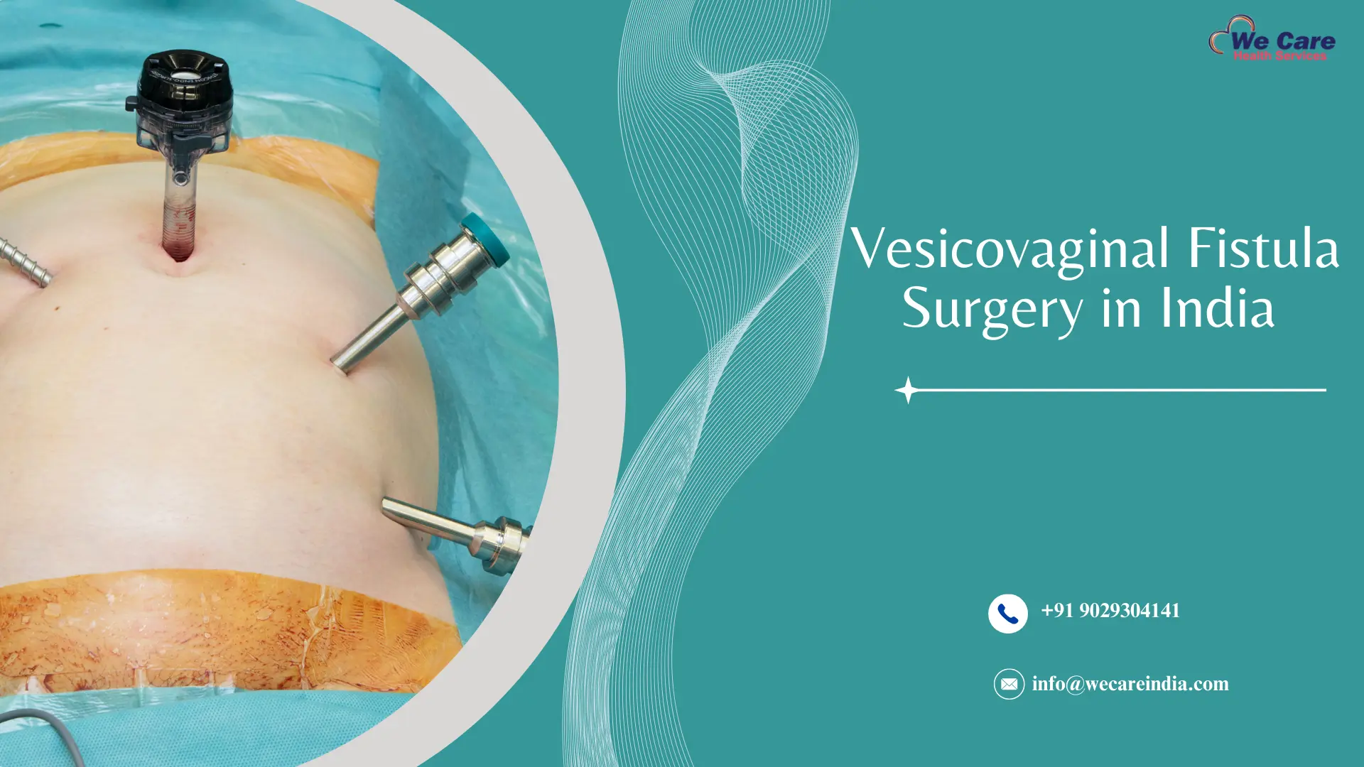 Vesicovaginal Fistula Surgery in India