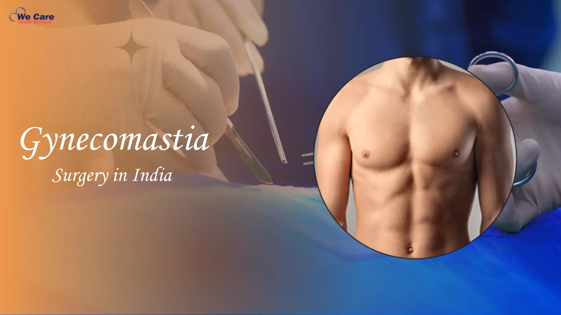 Gynecomastia Surgery in India