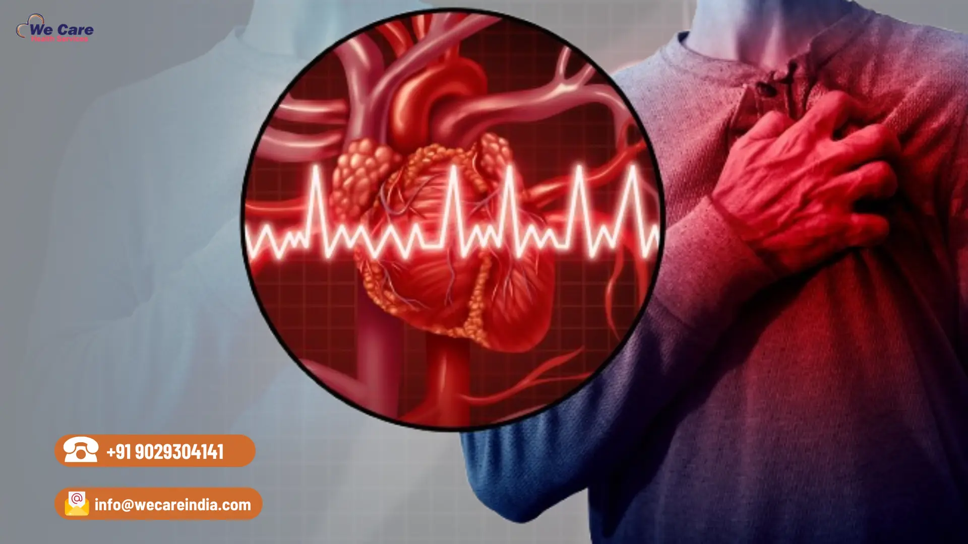Irregular Heartbeat Treatment in India