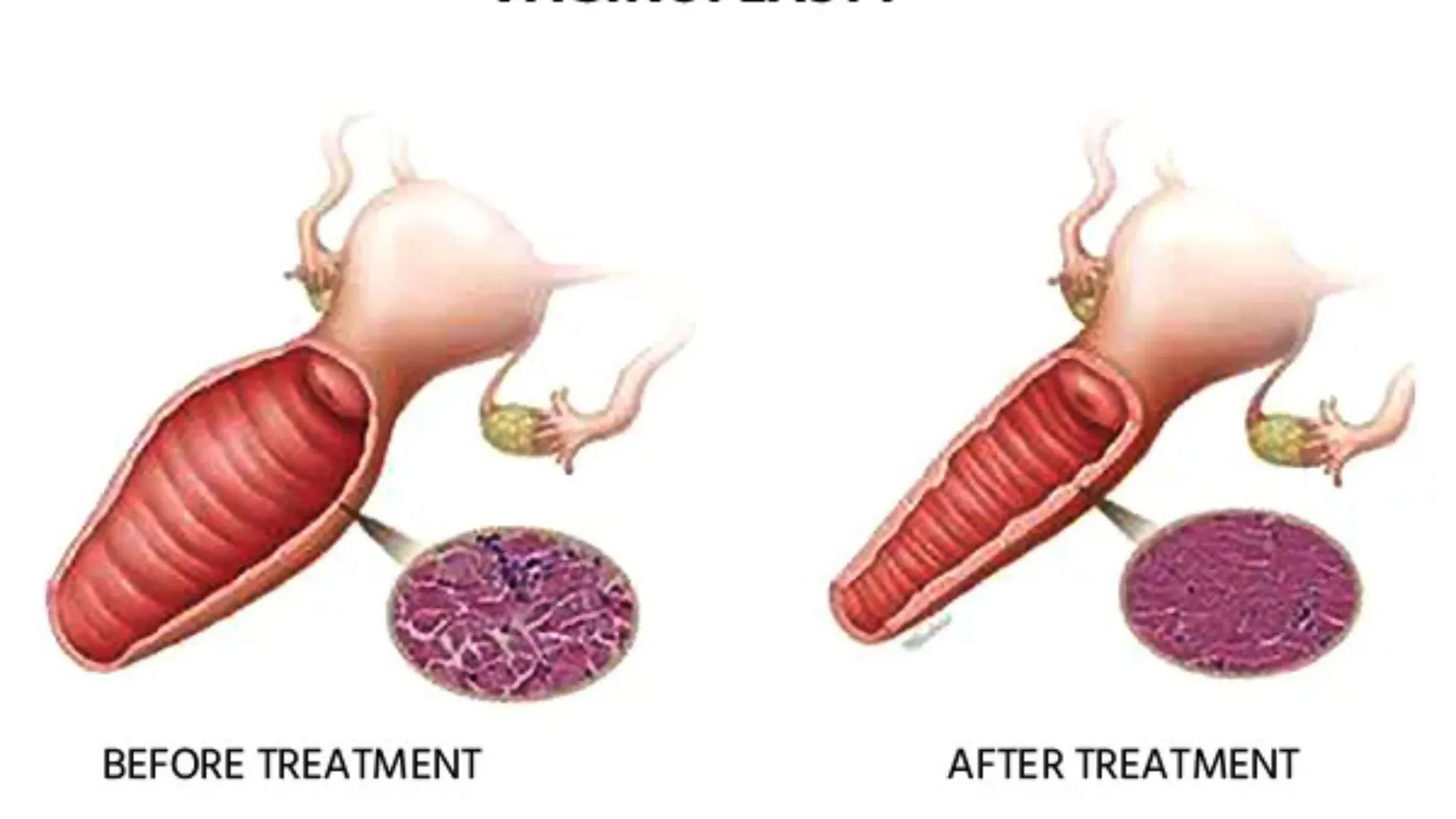 Vaginoplasty Surgery