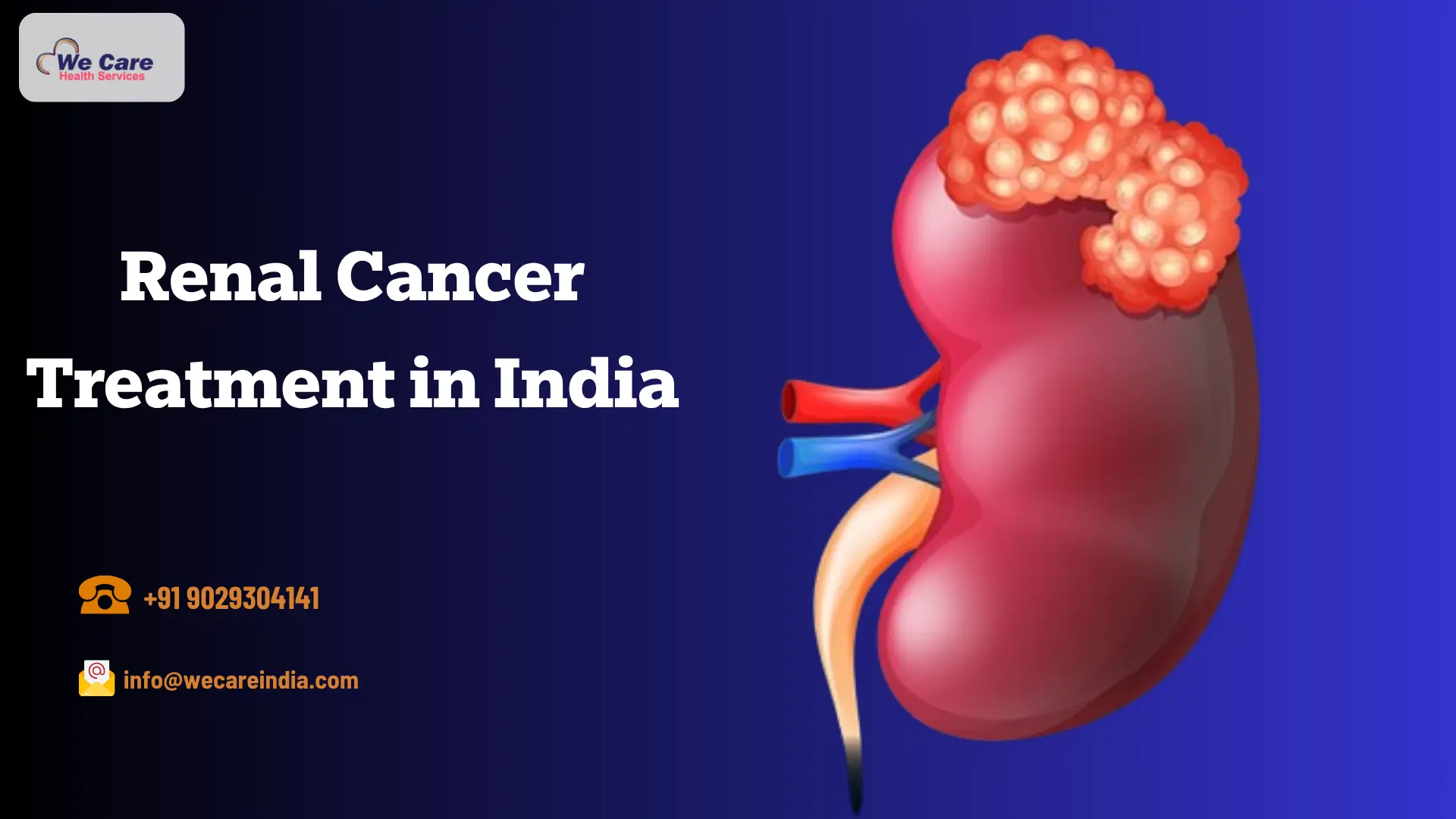 Renal Cancer Treatment in India