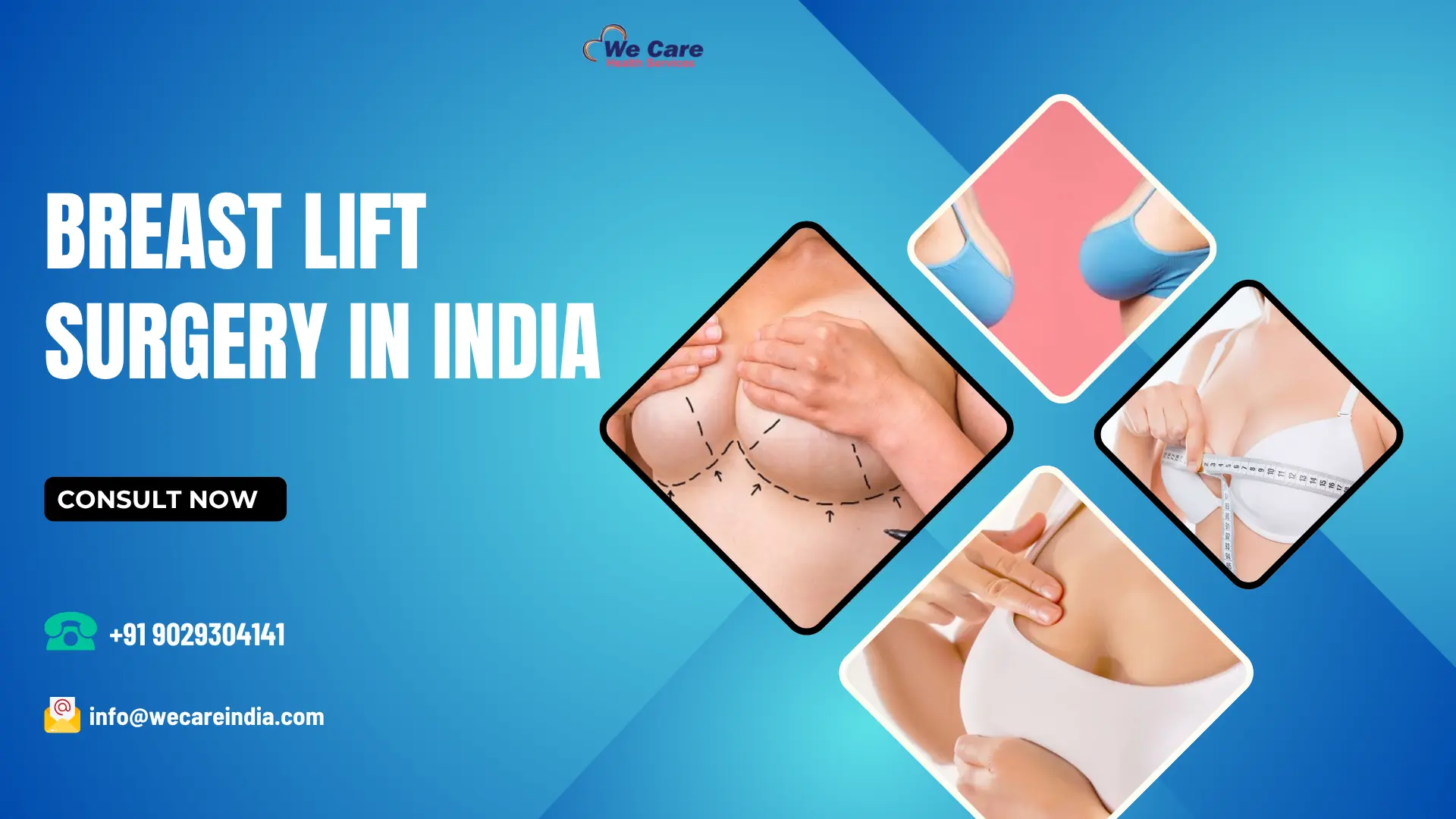 Breast Lift Surgery in India
