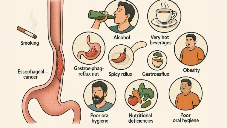 Causes of Oesophageal Cancer