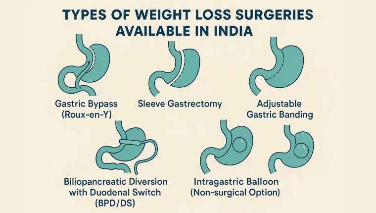 Types of Weight Loss Surgeries Available in India