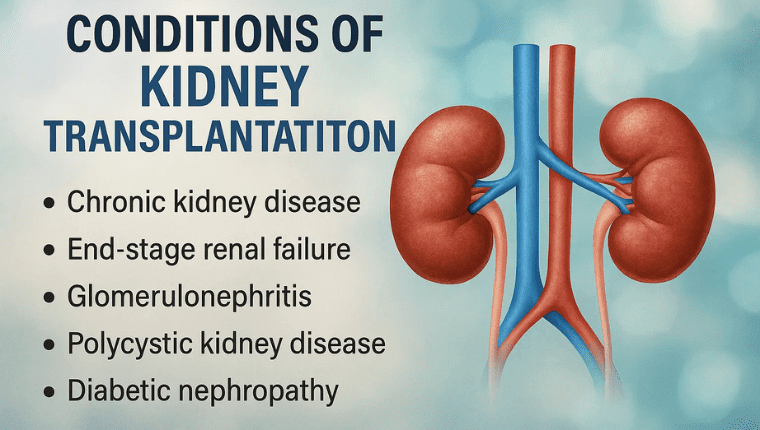 Conditions of Kidney Transplantation