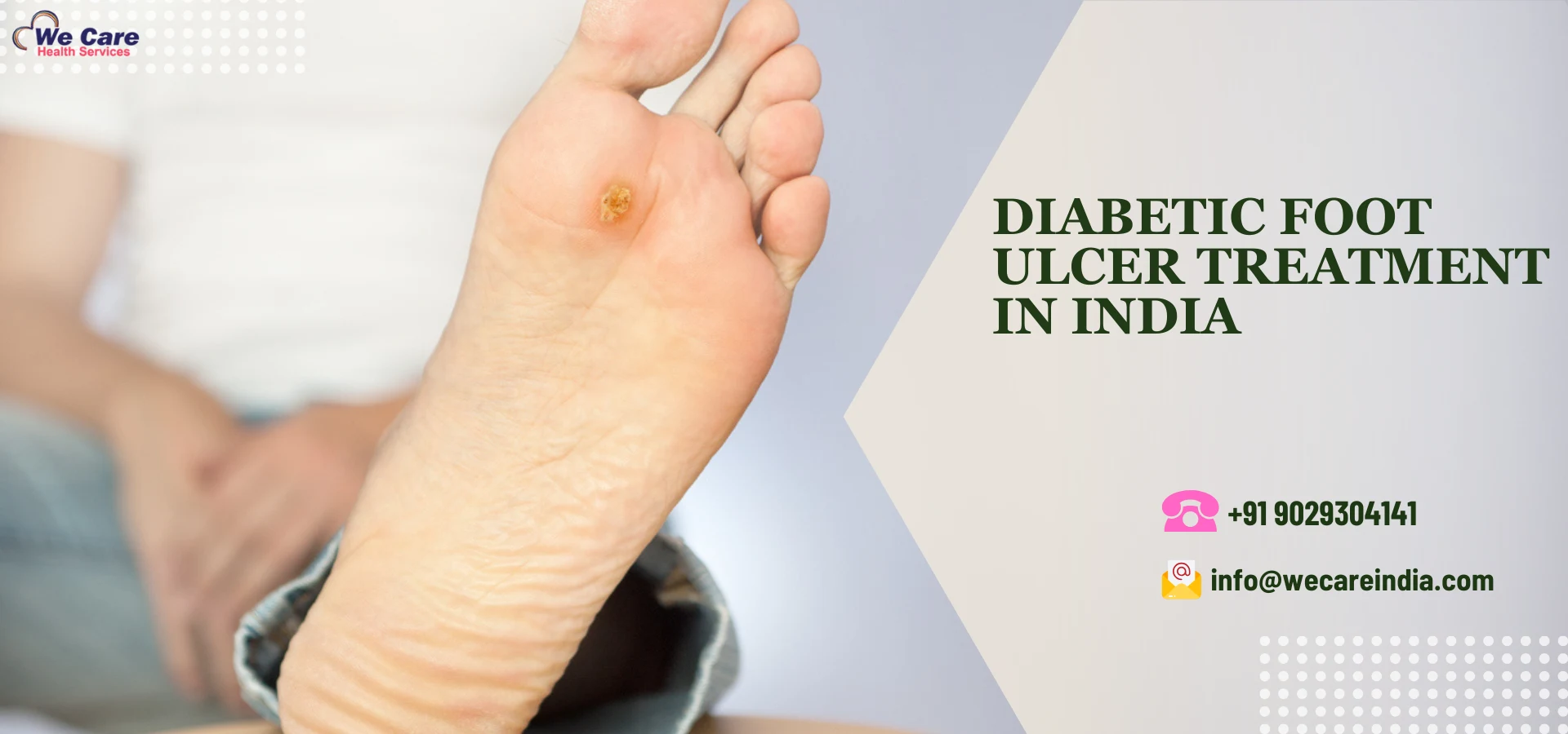 Diabetic Foot Ulcer Treatment in India