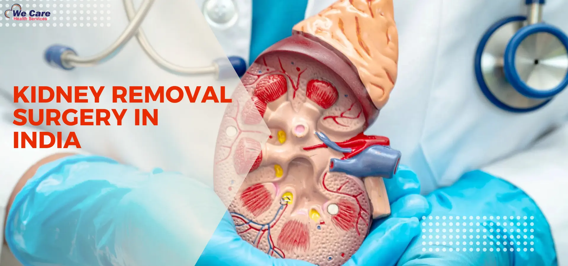 Kidney Removal Surgery in India