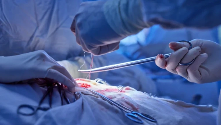 vascular surgery