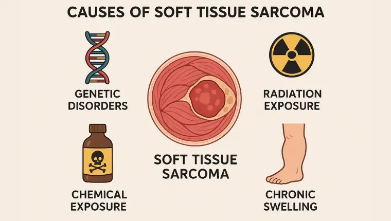 Cause of Soft Tissue Sarcoma
