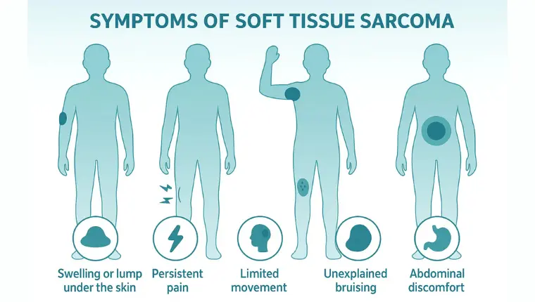 Symptoms of Soft Tissue Sarcoma