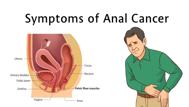 Symptoms of the Anal Cancer