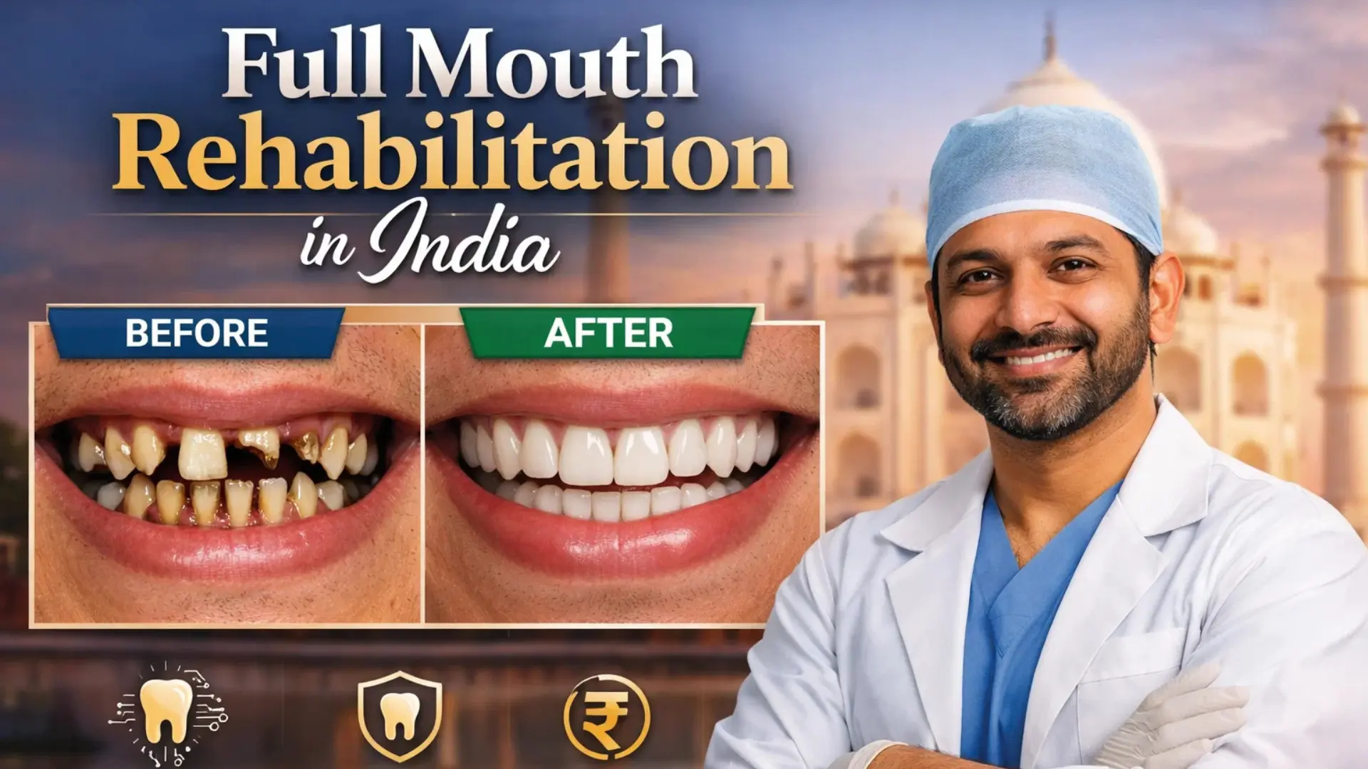 Full Mouth Rehabilitation in India