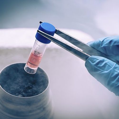ivf process