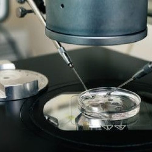 IVF treatment