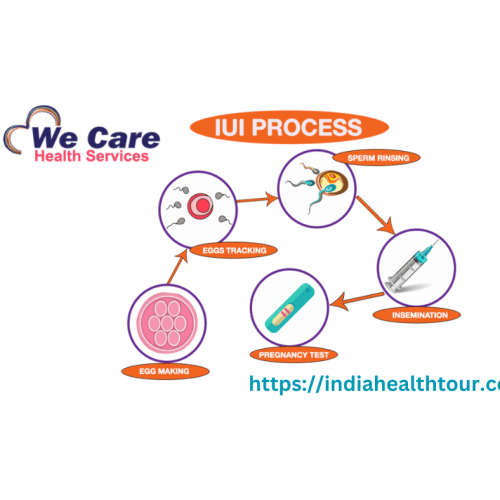 IUI Treatment Cost in India