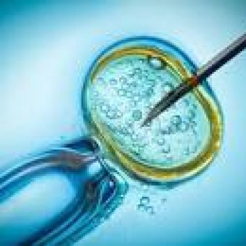 IUI Cost in delhi