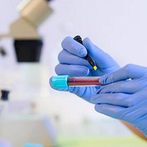 plasma therapy image